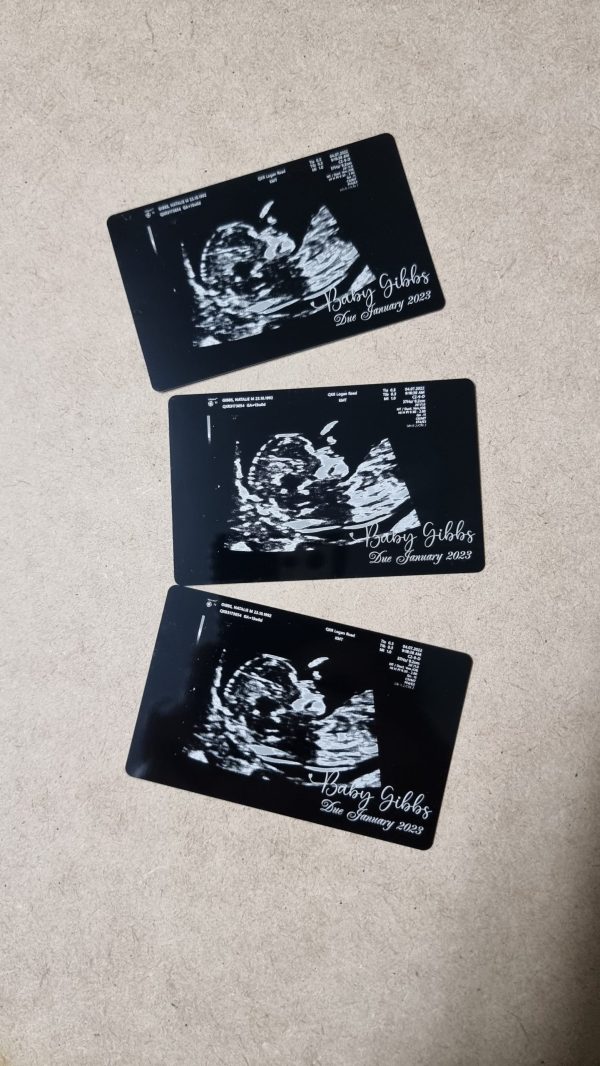 Pregnancy Baby Sonogram Ultrasound Photo on Aluminium Card - Image 2