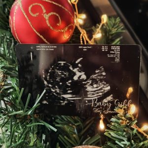 Pregnancy Baby Sonogram Ultrasound Photo on Aluminium Card
