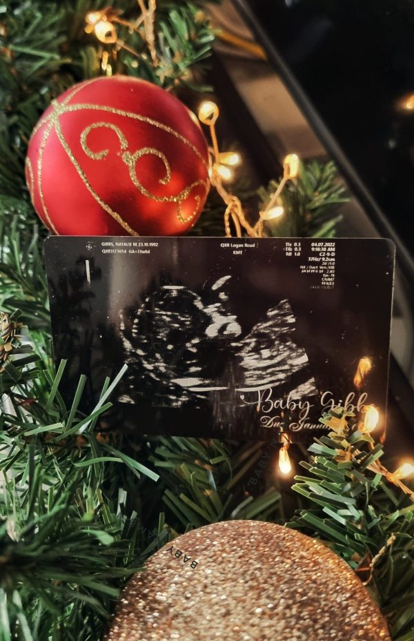 Pregnancy Baby Sonogram Ultrasound Photo on Aluminium Card