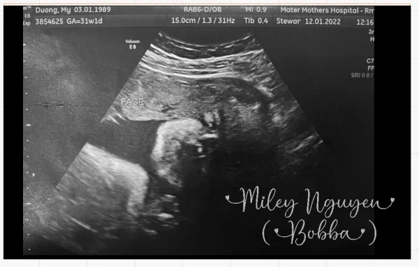 Sonogram Card Example